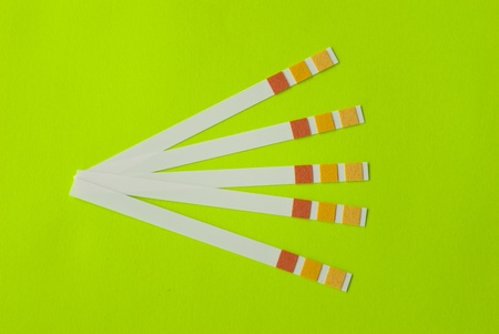 Litmus strips for measurement of acidityの写真素材