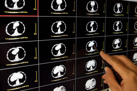 Doctor making a diagnosis from a patient s x-rayの写真素材