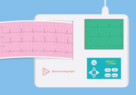 Electrocardiograph with monitor and ecg strip illustrationのイラスト素材