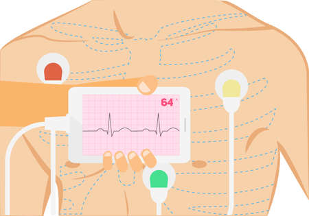 Mobile ecg conceptual illustration. Hand holding smartphone with ecg stripのイラスト素材