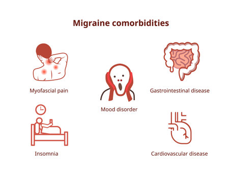 Common migraine comorbidities. Diseases associated with migraine depicted with icons: depression,...