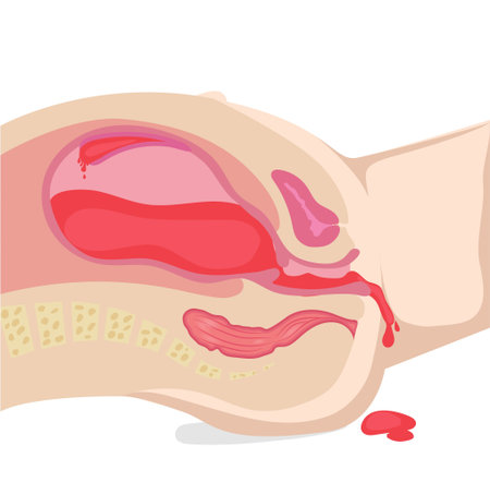 Illustration of the bleeding during pregnancy. Postapartum hemorrhage - blood is coming out of the wombのイラスト素材