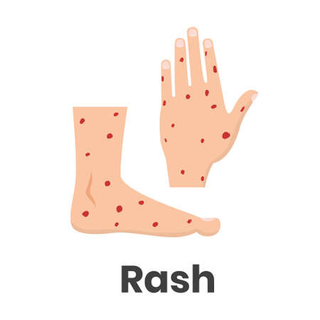 Hemorrhagic rash icon on feet and hands conceptual vector illustrationのイラスト素材
