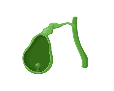 Illustration of the gallbladder mass. Vector image of the gallbladder cancer - biliary adenocarcinomaのイラスト素材