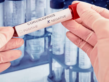 Corona virus. Coronavirus 2019-nCoV Blood Test. Pandemic virusの写真素材