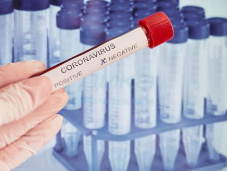 Corona virus. Coronavirus 2019-nCoV Blood Test. Pandemic virus  .の写真素材