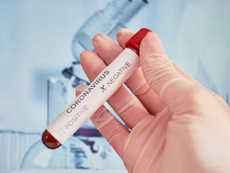 Corona Virus in Lab. Scientist hold Blood Test. New Epidemic Coronavirus 2019 nCoV. Coronavirus COVID-19 test Negative. Corona virus.の写真素材
