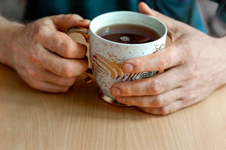 Male hands with vitiligo discoloration disease (spotty loss of skin color), holding a gilded cup of hibiscus tea. The tea leaves are on the table.の写真素材