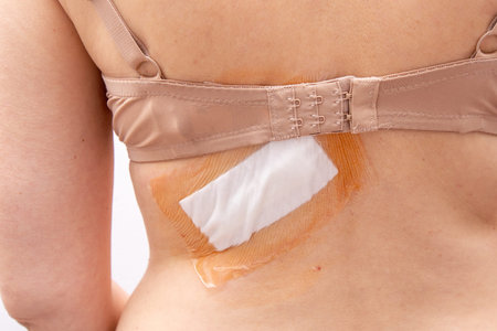 Adhesive bandage and surgical dressing after back surgery on a woman.