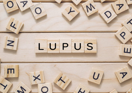 A wooden board with a bunch of wooden letters scattered around it. The letters spell out the word Lupusの写真素材