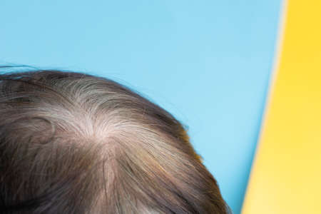 Head of an elderly woman with gray hairの写真素材