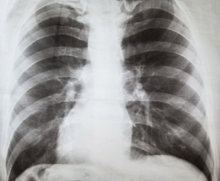 X-ray of human lungs, medical researchの写真素材