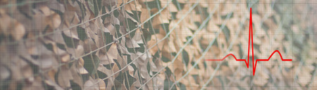 Post Traumatic Stress Disorder Concept, Heart rhythm.の写真素材