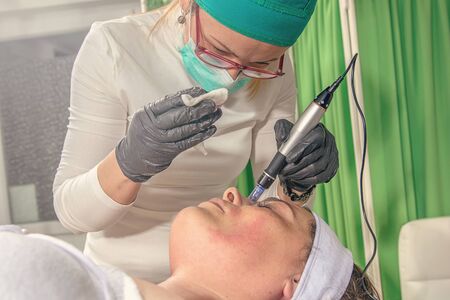 Beautician performs a needle mesotherapy treatment on a woman face.の写真素材