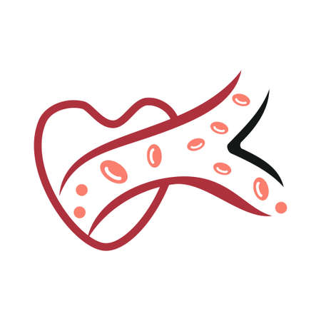 Cholesterol in artery health risk vector design Illustrationのイラスト素材