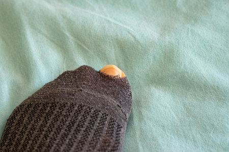 Worn black sock with a hole at the toe is placed on soft light blue fabric, showcasing the texture...
