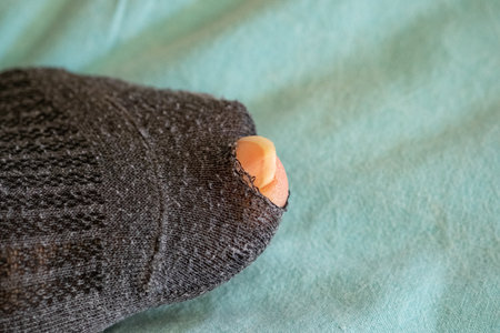 Worn sock with a hole exposing a long toenail, placed on a soft surface, highlighting the realities of daily life and personal grooming issuesの写真素材