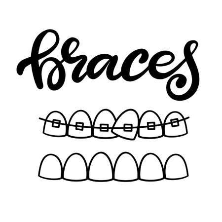 Lettering illustration about dental health care with the image of braces on teeth. EPS10. Vector image of the stages of orthodontic treatment for posters for dental clinic.のイラスト素材