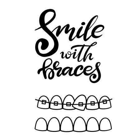 Lettering illustration about dental healthcare with the image of braces on teeth. EPS10. &#xD;Vector image of the stages of orthodontic treatment for posters for dental clinic.のイラスト素材