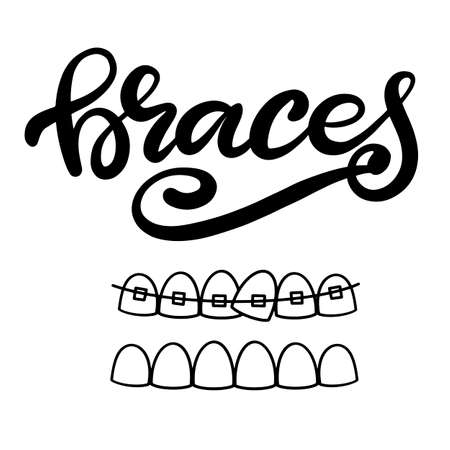 Lettering illustration about dental healthcare with the image of braces on teeth. EPS10. &#xD;Vector image of the stages of orthodontic treatment for posters for dental clinic.のイラスト素材