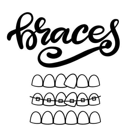 Lettering illustration about dental healthcare with the image of braces on teeth. EPS10. &#xD;Vector image of the stages of orthodontic treatment for posters for dental clinic.のイラスト素材