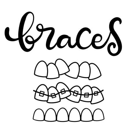Lettering illustration about dental healthcare with the image of braces on teeth. EPS10. &#xD;Vector image of the stages of orthodontic treatment for posters for dental clinic.のイラスト素材