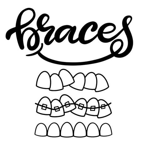 Lettering illustration about dental healthcare with the image of braces on teeth. EPS10. &#xD;Vector image of the stages of orthodontic treatment for posters for dental clinic.のイラスト素材