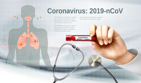 Coranavirus background with doctor holding tube with pasitiv test and stethoscope. Vectorのイラスト素材