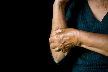 Old hands itching on arm in black background, dermatitis conceptの写真素材