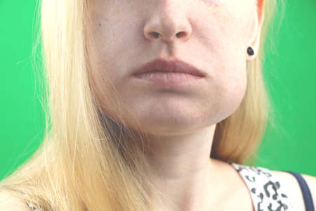 Teeth Problem. Gumboil, flux and swelling of the cheek. Closeup Of Beautiful Sad Girl Suffering From...