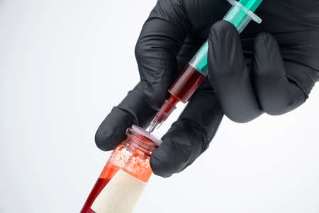 Syringe and test tube close up. The doctor does a blood sampling. Laboratory where blood tests are...