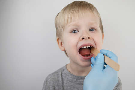 An otolaryngologist examines a child's throat with a wooden spatula. A possible diagnosis is inflammation of the pharynx, tonsils or pharyngitis. The concept of treatment and prevention of childhood diseasesの写真素材