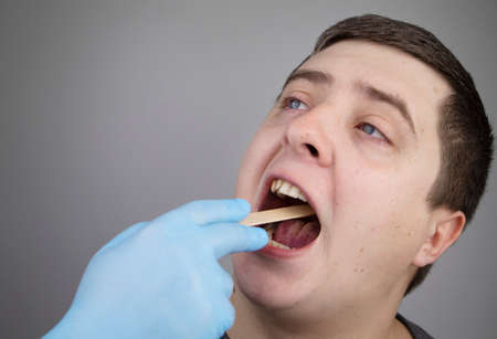An otolaryngologist examines a man's throat with a wooden spatula. A possible diagnosis is inflammation of the pharynx, tonsils or pharyngitis. The concept of treatment and prevention of throat diseasesの写真素材