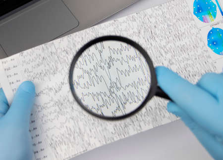 A neurologist examines an encephalogram of a patientâ€™s brain. Schedule of...