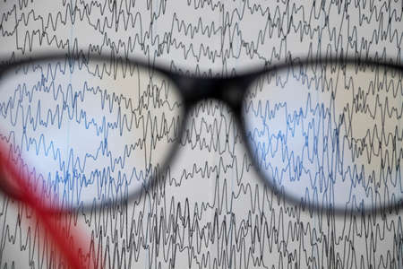 A neurologist examines an encephalogram of a patientâs brain. Schedule of electroencephalograms - study of brain currents for signs of epilepsy and pathologies of the nervous systemの写真素材