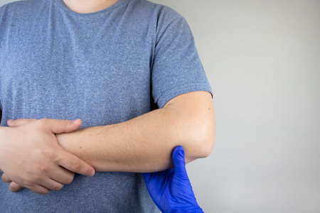 A man suffers from elbow pain. Damaged elbow joint, bone fracture, or sprain. Hand injury and flexion pain conceptの写真素材