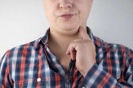 The man has a second chin. The concept of obesity and plastic surgery of the face. Close-up of a patient's sad face and his fat on his neck.の写真素材