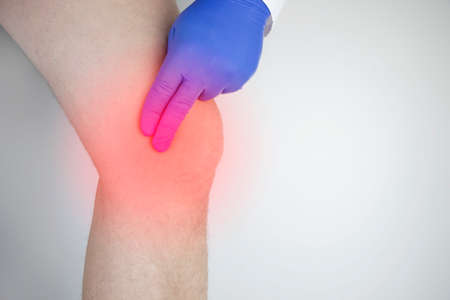 A man suffers from knee pain. Examination by an orthopedist and traumatologist. Redness and swelling of the legs, torn meniscus or knee bursitisの写真素材