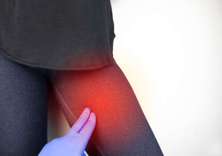 A woman suffers from pain in the inner thigh. The concept of treating a hip joint for trauma, myositis, impaired nerve endingsor osteoarthritis.の写真素材
