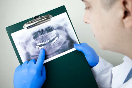 A dentist doctor examines a radiography of the teeth of a patient who has problems and teeth are inserted. The concept of research and diagnosisの写真素材
