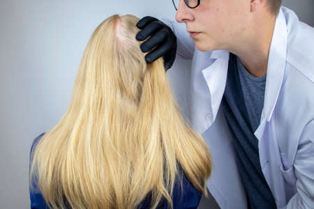 A doctor trichologist conducts a study of the hair of a blonde. Alopecia treatment. Hair loss, alopecia, itching, burning in the head, seborrhea or brittle endsの写真素材