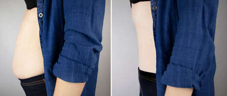 The girl shows the results of work on the body. Before and after a thick and thin waist. In the...