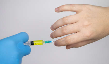 An orthopedic surgeon gives an injection in the finger joint. Treatment of osteoarthritis with...
