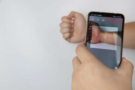 The man shows his hand with a chip implanted. The concept of chipping and implantation of electronic technologies into the human body. Cybernetics and the nanofutureの写真素材