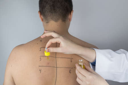 An allergist in the laboratory conducts an allergy prick-test.