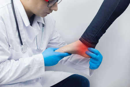 An orthopedic examines a woman's leg. Heel pain, tendon stretching, inflammation, heel spur. Foot Disease Treatment Concept. The doctor examinesの写真素材