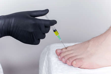 An orthopedic surgeon gives an injection in the finger joint. Treatment of osteoarthritis with hormonal drugs or drugs based on hyaluronic acid. Help with diseases that damage the cartilage of the jointの写真素材