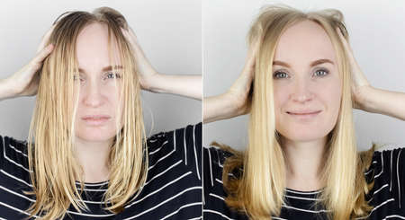 Before and after. The girl looks in front of the mirror at her oily hair. Problematic scalp and increased secretion of the sebaceous glands. Hair care. Oily hair care and treatment conceptの写真素材