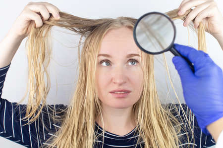 The girl looks in front of the magnifier at her oily hair. Problematic scalp and increased secretion...