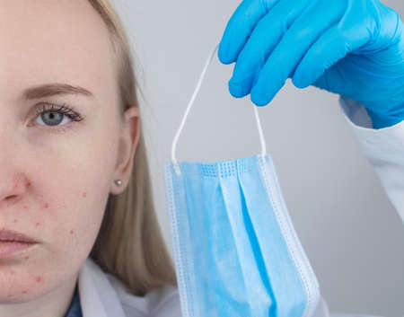 Doctor removes the protective mask and shows irritation on face skin. Antiviral measures. Means of protection . Long wearing of a mask. Acne on face and chafing. Dry lips and red dotsの写真素材